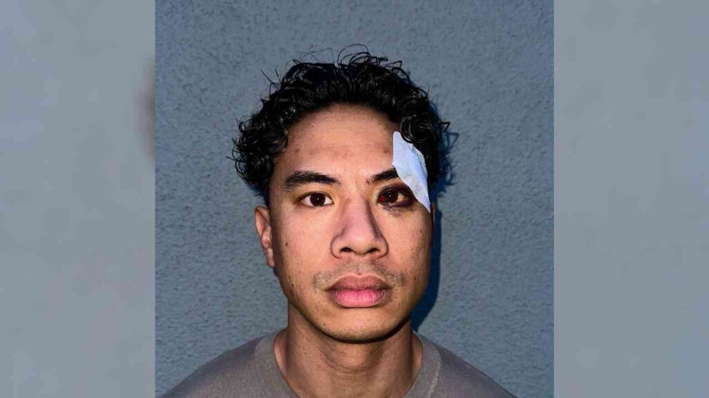 Mann mit einem Verband über dem rechten Auge und einer Schwellung auf der linken Gesichtshälfte vor einem grauen Hintergrund.