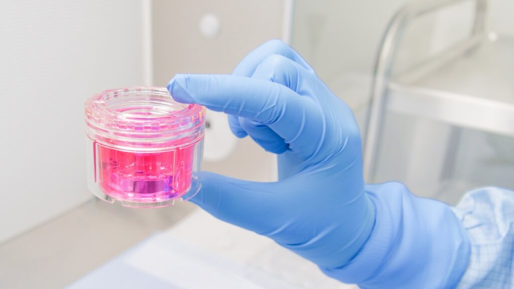 So viele Gewebespenden wie noch nie eine Gemeinschaftsleistung!