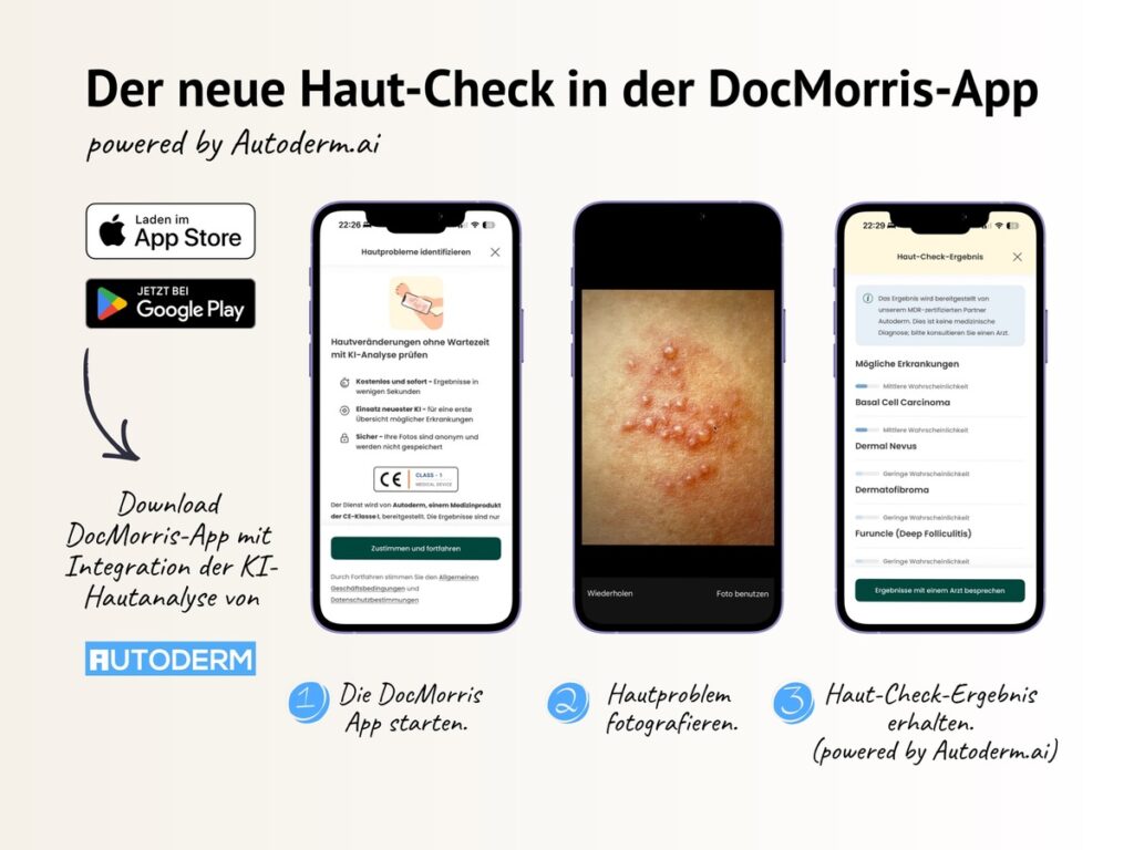 Autoderm ergänzt digitales Gesundheitsökosystem von DocMorris mit KI Hautanalyse