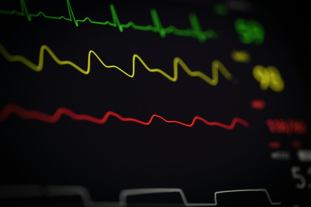 Symbolbild: EKG-Kurve auf einem Monitor