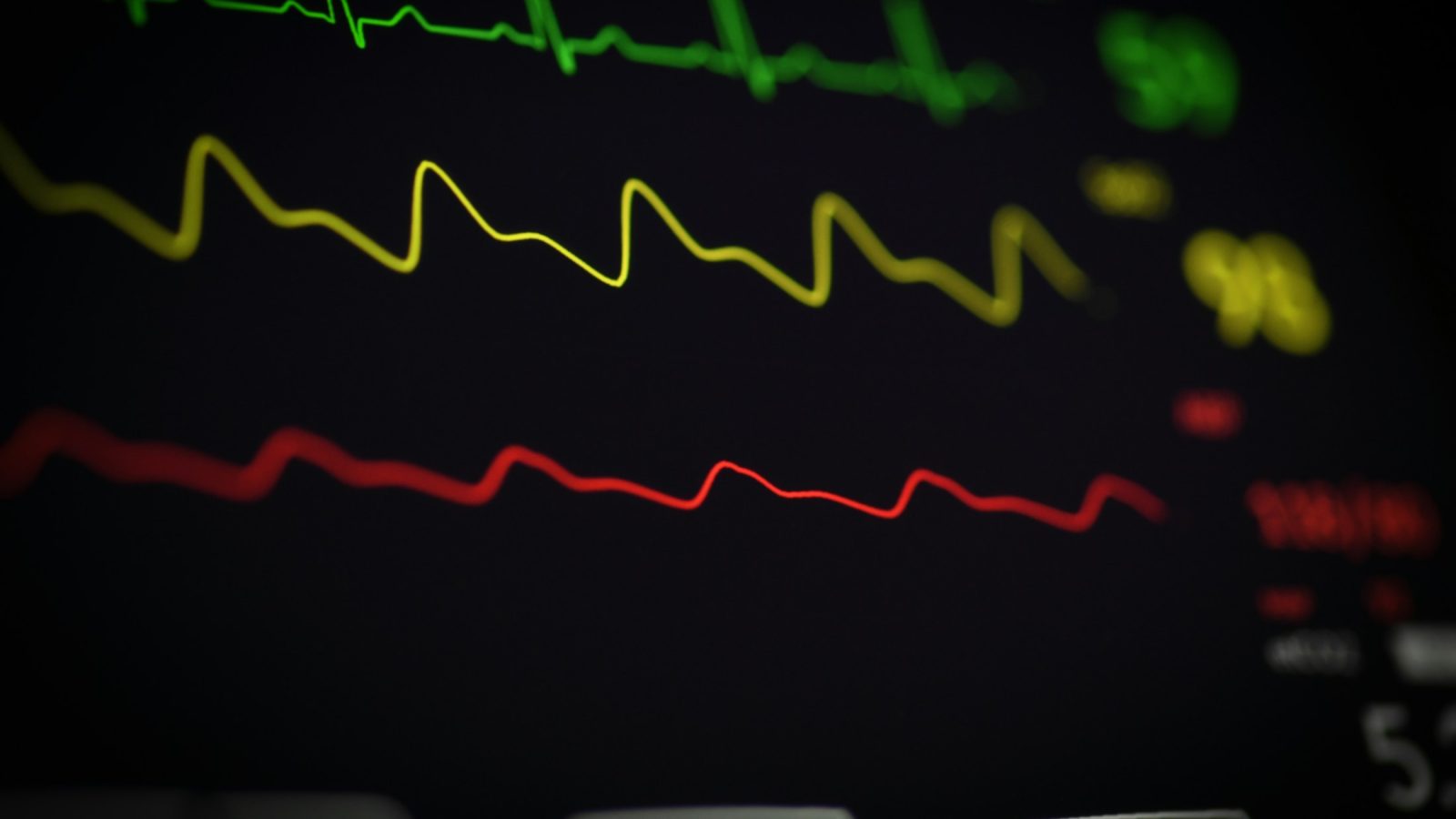 Symbolbild: EKG-Kurve auf einem Monitor