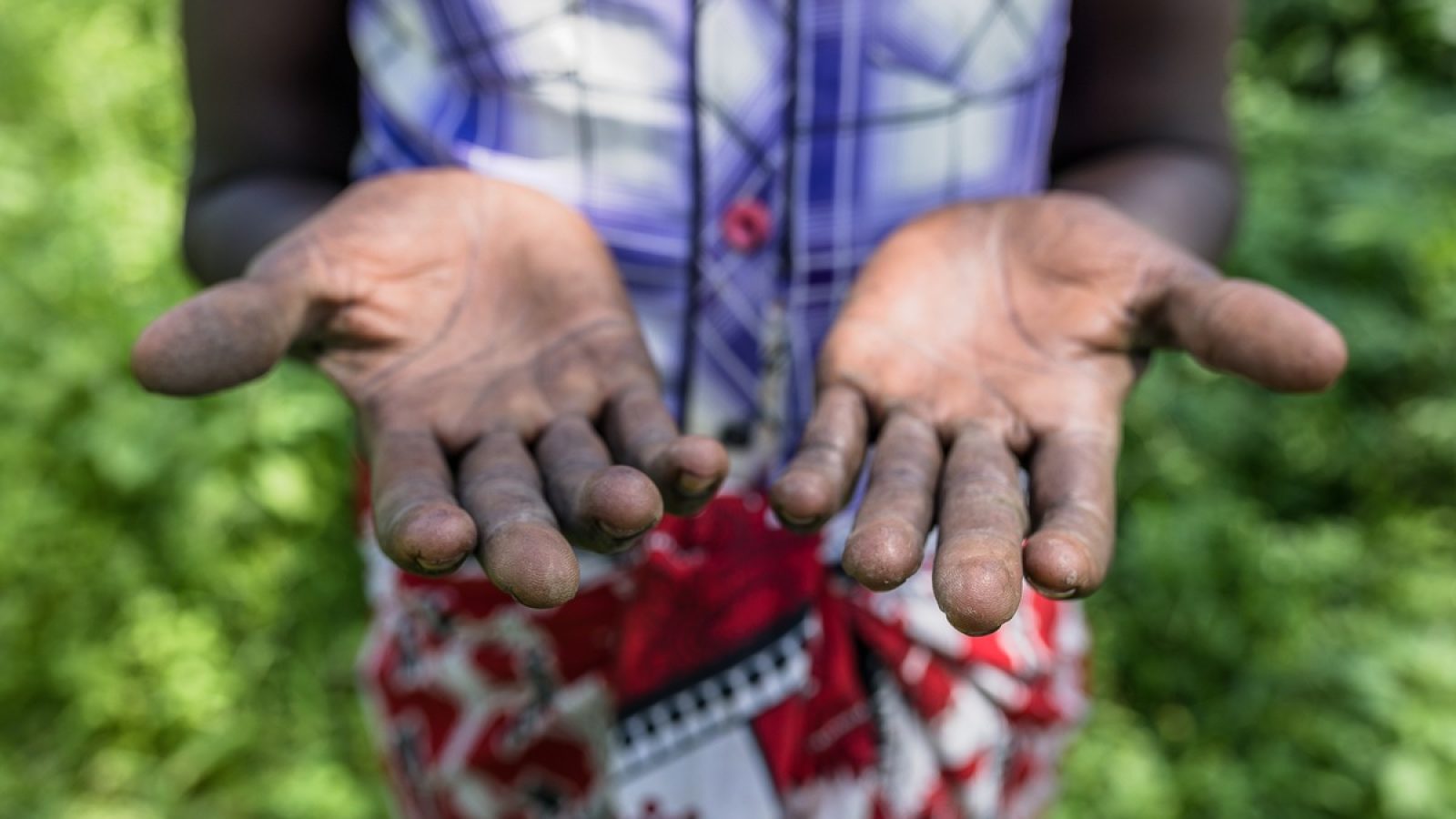 Foto: BRIAN OTIENO/DSW / Weiterer Text über ots und www.presseportal.de/nr/24571 / Die Verwendung dieses Bildes für redaktionelle Zwecke ist unter Beachtung aller mitgeteilten Nutzungsbedingungen zulässig und dann auch honorarfrei. Veröffentlichung ausschließlich mit Bildrechte-Hinweis.